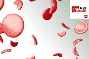 sickle cell
