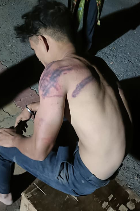 Youth kidnapped and brutally beaten; Case registered against three