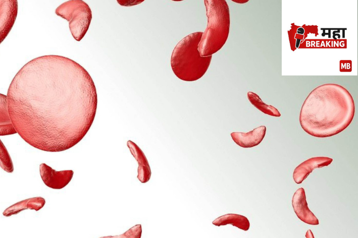 sickle cell